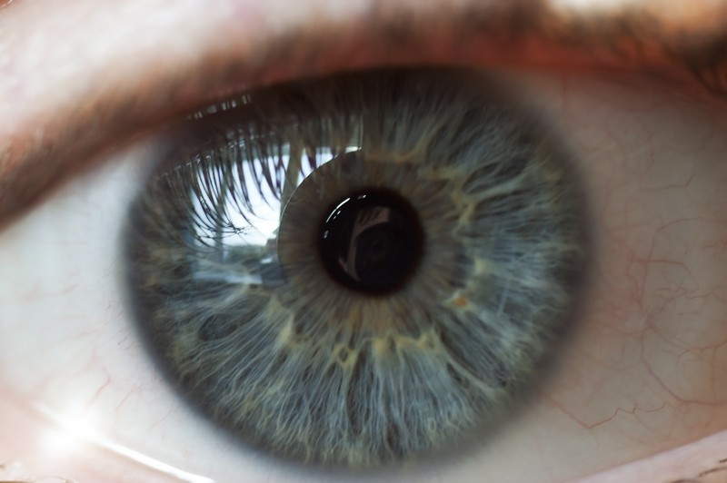 Retinal Artery Occlusions