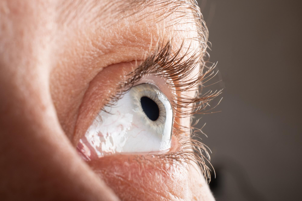 Uveitis