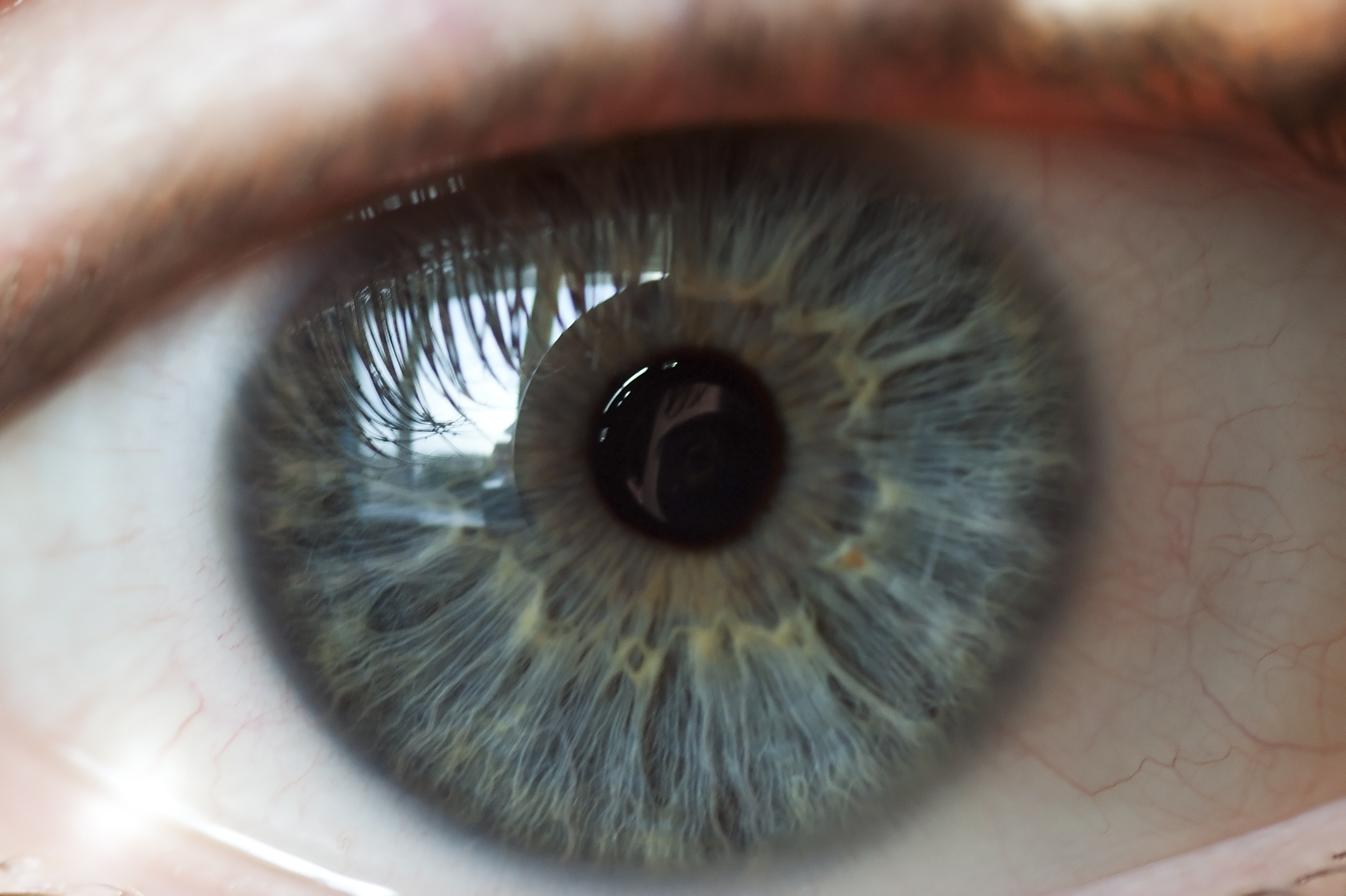 Macular Hole Repair